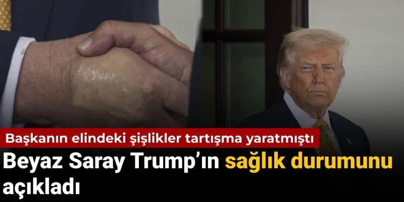 79 yaşındaki başkanın elindeki doku hasarı tartışma yaratmıştı: Beyaz Saray Trump'ın sağlık durumunu açıkladı