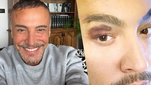 Cenk Eren sahne kazası geçirdi