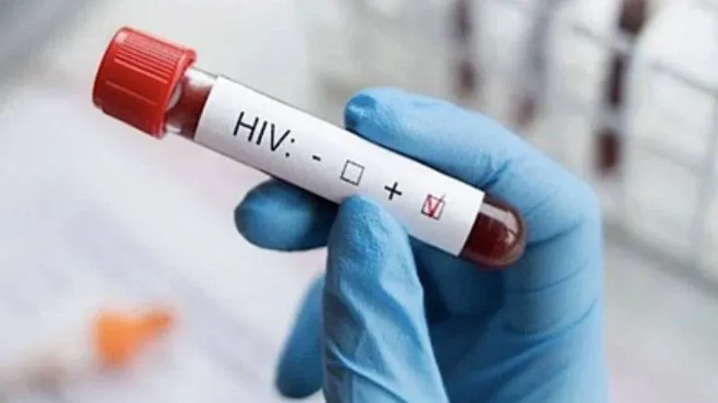 HIV Alarmı: Türkiye'de Vaka Sayıları Neden Katlandı? İşte Cevaplar!