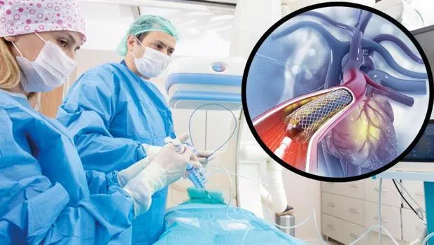 Uzmanlardan ‘anjiyo bağımlısı olmayın’ uyarısı