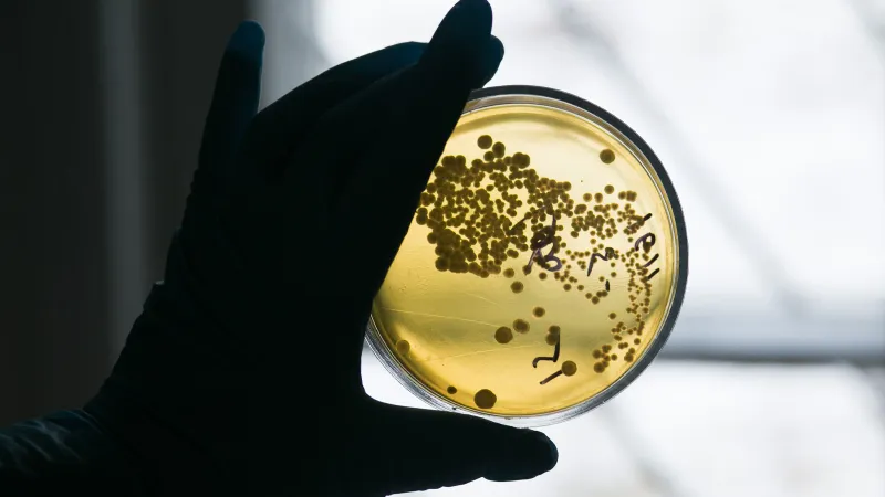 Almanya'da Ölümcül Salgın! Çocuklar Risk Altında mı?